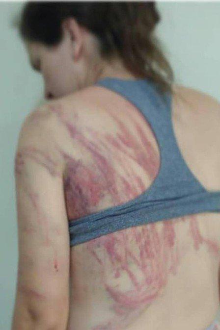 Casada há mais de dez anos denuncia marido por agressão