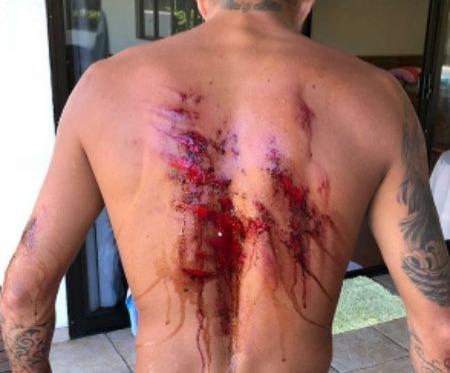 Rapaz dá tiro de espingarda no vizinho