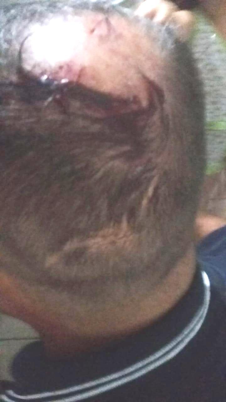 Homem leva golpe de facão na cabeça após briga