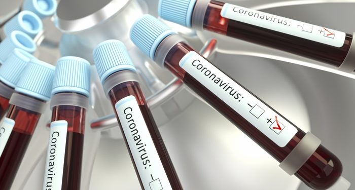 Saiba quando alguém pode ser considerado curado da Covid-19