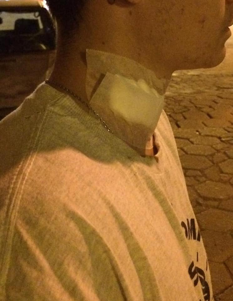 Linha com cerol corta pescoço de jovem em Siqueira Campos