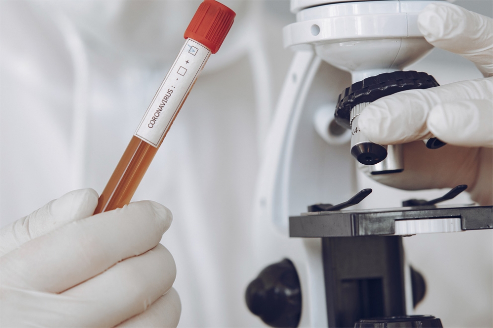 UENP divulga resultado de pesquisa sobre a Covid-19 no Norte Pioneiro