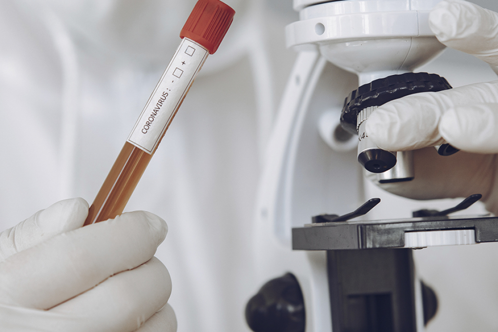 Após queda em agosto, diagnósticos da Covid-19 voltam a crescer em setembro no Norte Pioneiro