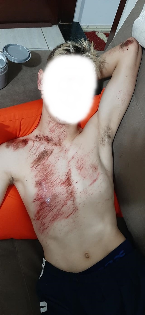 Jovem atropelado por brazense diz ter nascido de novo