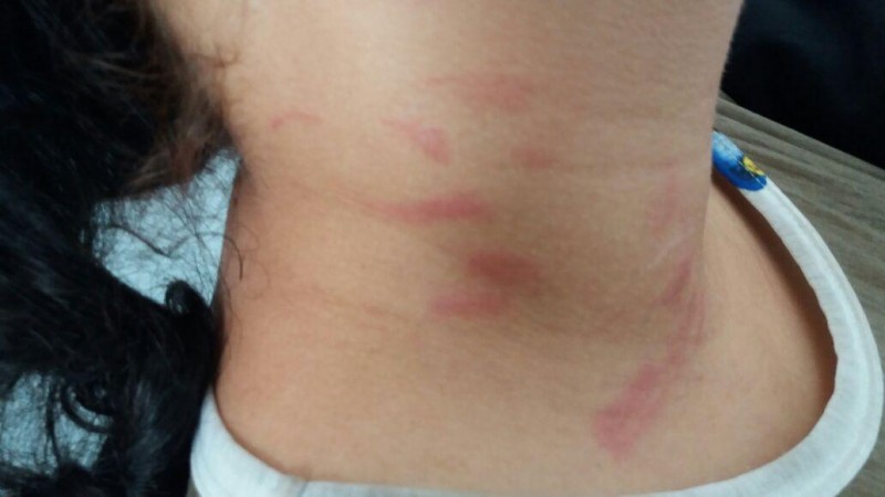 Mulher é agredida a socos ao tentar terminar relacionamento