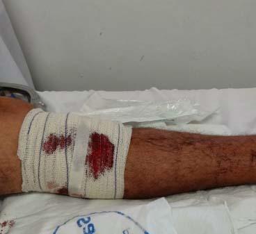 Homem é baleado dentro de rio enquanto tomava banho