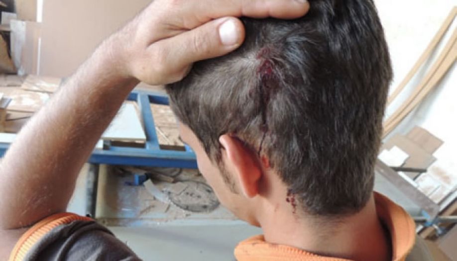 Vítima leva coronhada na cabeça durante assalto a mão armada