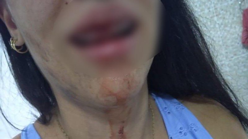 Mulher vai parar no hospital após ser agredida pelo marido em Arapoti