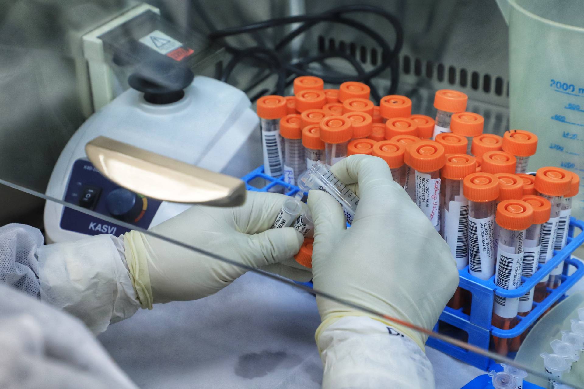 Norte Pioneiro registra primeiro caso da variante delta da Covid-19