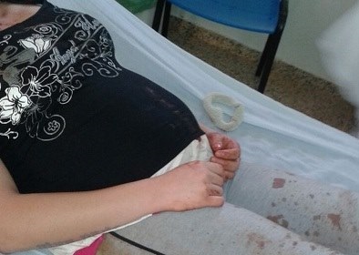 Grávida de cinco meses vai parar no hospital após levar socos e chutes do ex-namorado