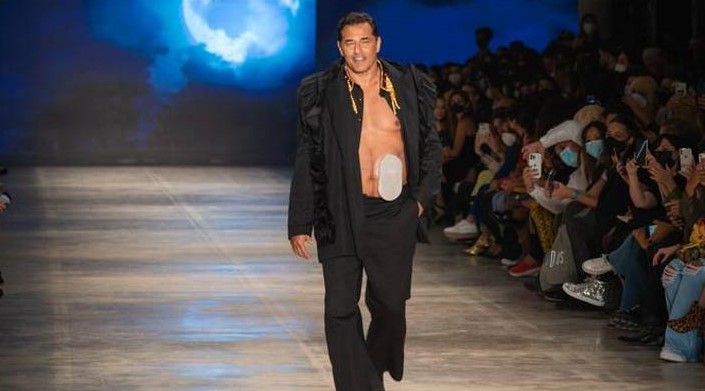 Luciano Szafir, ex de Xuxa Meneghel, desfila com bolsa de colostomia na São Paulo Fashion Week