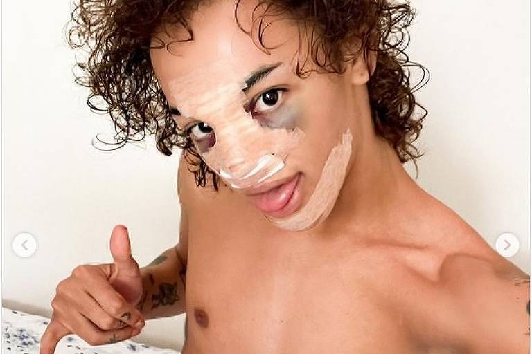 Pabllo Vittar publica foto após rinoplastia e diz adorar 'intervençãozinha'