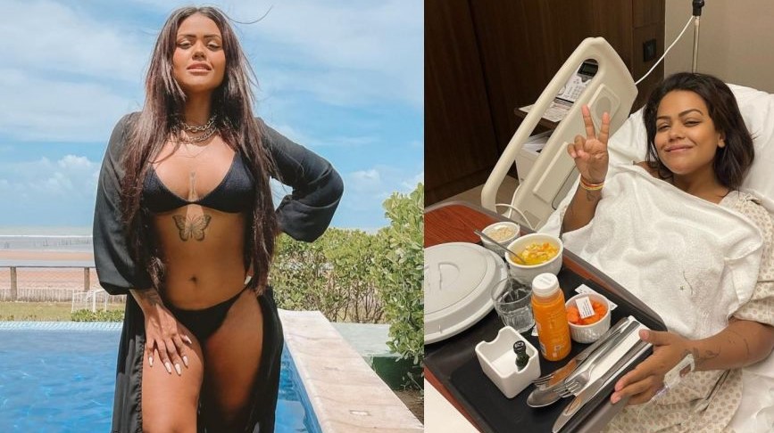 Camila Loures faz lipoaspiração nas coxas devido à doença e retira oito quilos de gordura