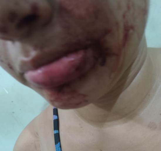 Mulher é espancada pelo sogro em Bandeirantes