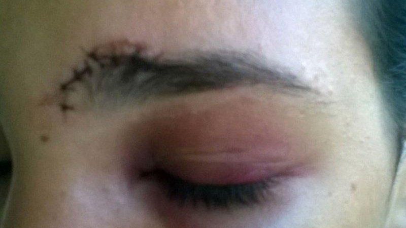 Mulher tenta buscar os filhos e acaba apanhando do ex-marido embriagado