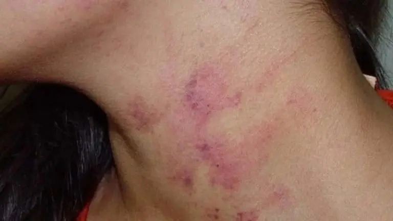 Homem descumpre medida e agride ex-mulher em seu local de trabalho