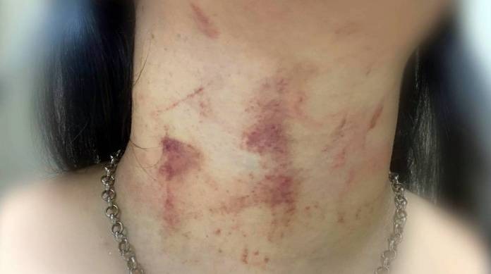 Mulher tenta evitar que o marido brigue com seu sogro e é enforcada