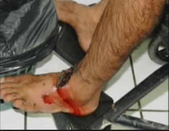 Homem leva tiro no pé por não pagar dívida de R$ 10