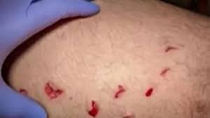 Dono de bar chama a polícia após levar mordida de um cliente