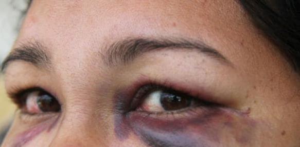 Comerciante protesta dívida e é agredida com soco no rosto dentro da própria loja