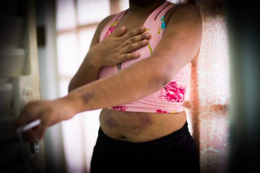 Mulher espera o marido dormir para pedir socorro e vai parar no hospital