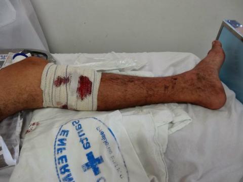 Motorista é atingido por tiro ao tentar fugir de assalto na rodovia