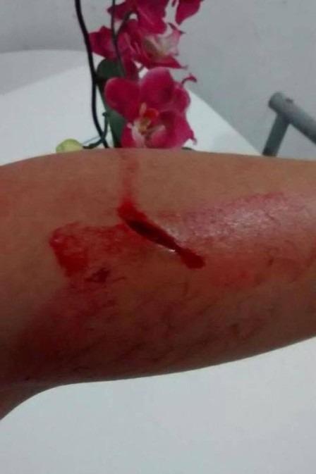 Após discussão, esposa leva facada do marido e vai parar no hospital