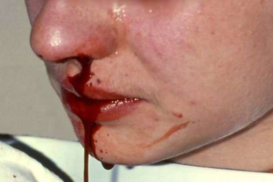 Filho agride própria Mãe com soco no nariz 