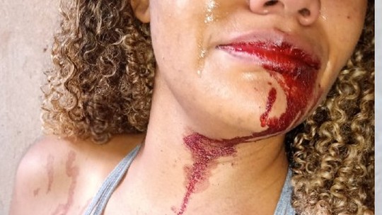 Agressor deixa esposa com a boca sangrando e acaba preso pela PM