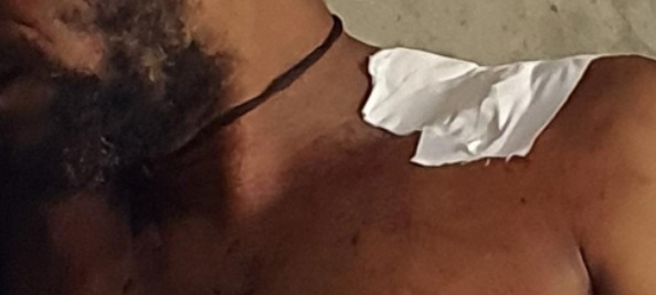 Homem vai parar no hospital após ser atingido por casinha de cachorro