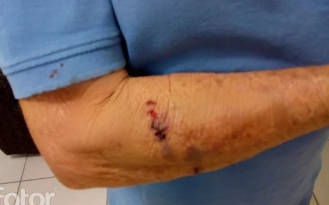 Homem faz denúncia após apanhar da namorada   