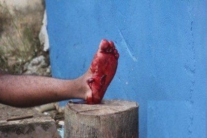 Homem dispara tiro no próprio pé ao tentar matar uma cobra