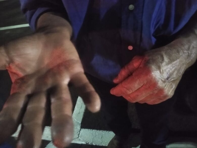 Idoso é agredido a pauladas pelo cunhado embriagado