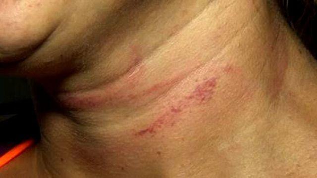 Esposa sai de casa e é agredida por marido que não aceita separação