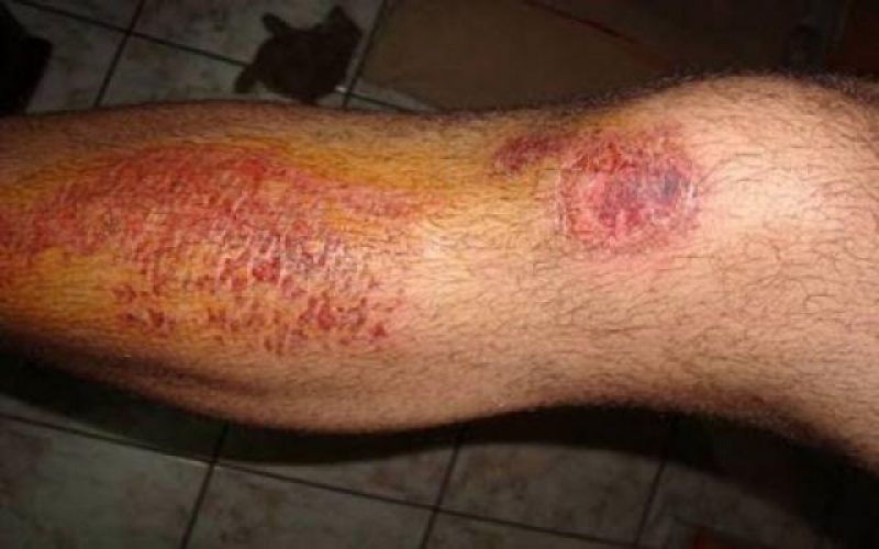 Homem fica ferido e desmaia após ser atropelado por cavalo