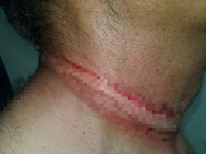 Mulher dá facada no pescoço do companheiro após discussão