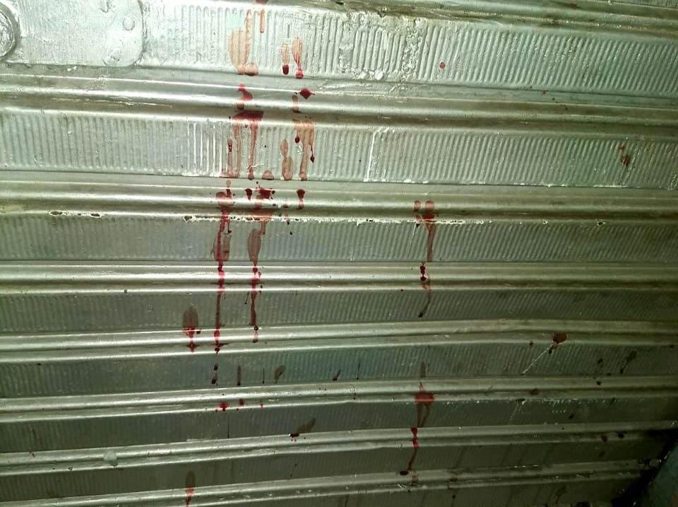 Marido e grávida de oito meses são esfaqueados por cunhado em Jaguariaíva
