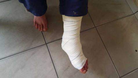 Homem vai visitar a ex-mulher e leva tiro no pé