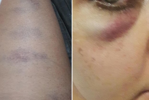 Mulher amassa carro e é espancada pelo marido