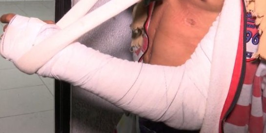 Homem é atropelado e motorista foge sem prestar socorro