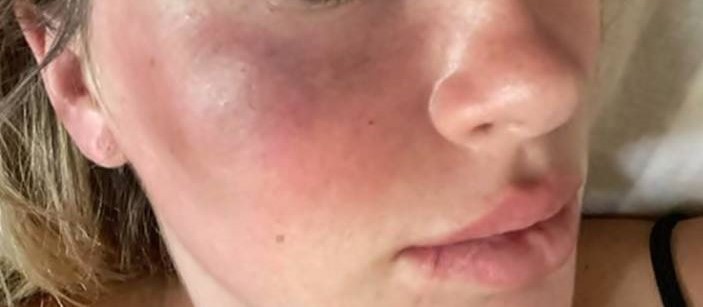 Mulher grávida é agredida após cobrar pagamento de limpeza  