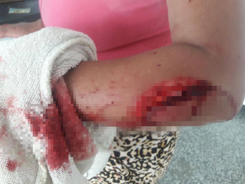 Mulher agride a si mesma após discussão com namorado 