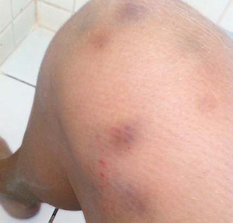 Agressor invade residência, espanca a ex-mulher e acaba preso após tomar calmante