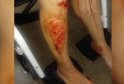 Mulher passeia com seu bebê e é atacada no Norte Pioneiro 