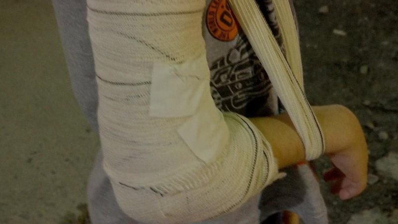 Mulher vai parar no hospital após filho lhe atingir com um facão