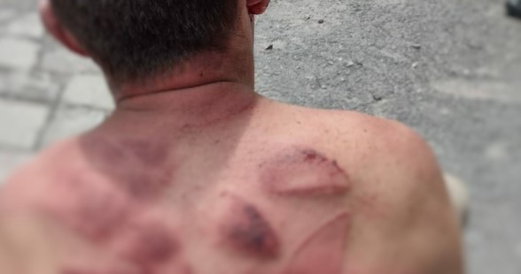 Briga de bar acaba em chutes e pauladas 