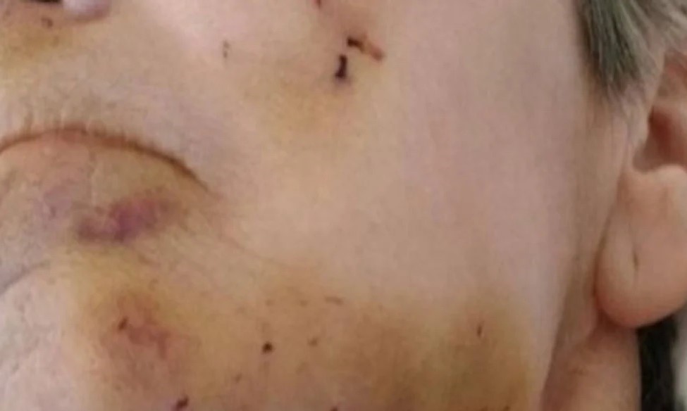 Idoso é agredido com uma bengala no Norte Pioneiro