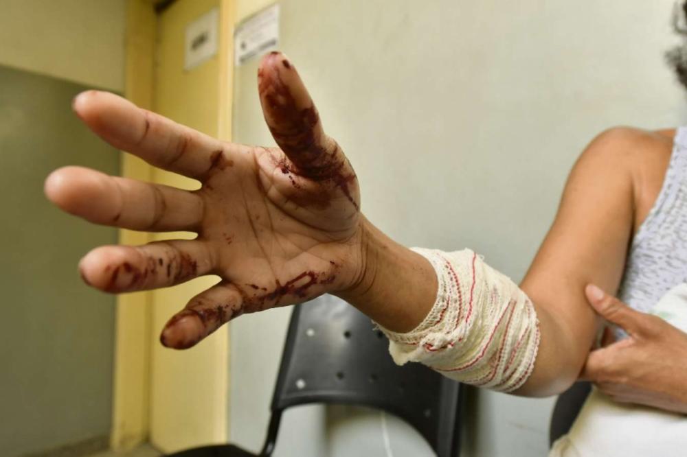 Agressor invade casa e dá facada na ex-cunhada