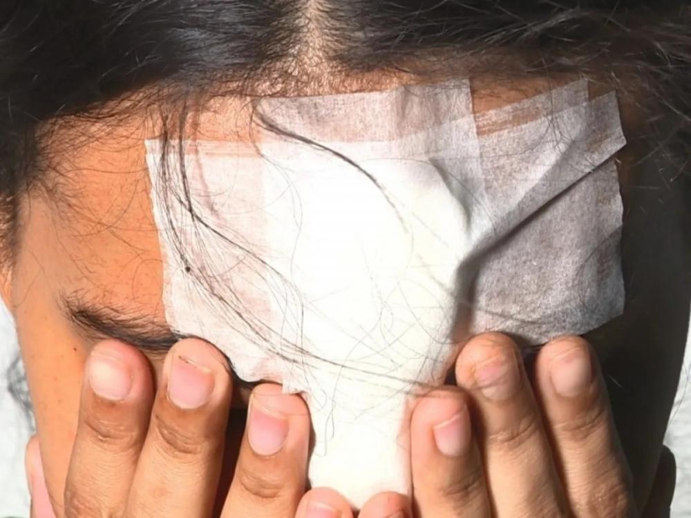 Mulher perdoa agressor, reata o relacionamento e leva soco na cara