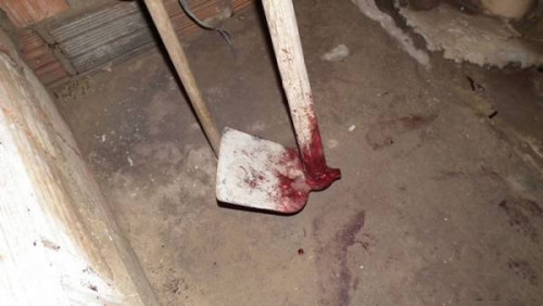 Filho dá enxadadas na cabeça da mãe e deixa mulher com o crânio exposto